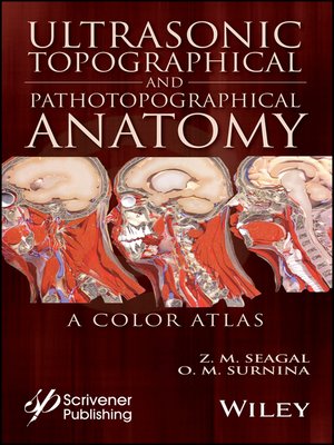 cover image of Ultrasonic Topographical and Pathotopographical Anatomy